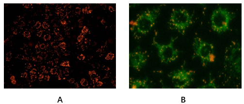 fig. hela cells stained with abbkine mitochondrial membrane potential assay kit (jc-1). a: red fluorescence indicates healthy mitochondria, b: green fluorescence indicates mitochondria in poor health (30min incubation in 20um cccp).